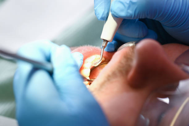 Best Urgent Care for Lost Fillings or Crowns in Sutton Alpine, AK